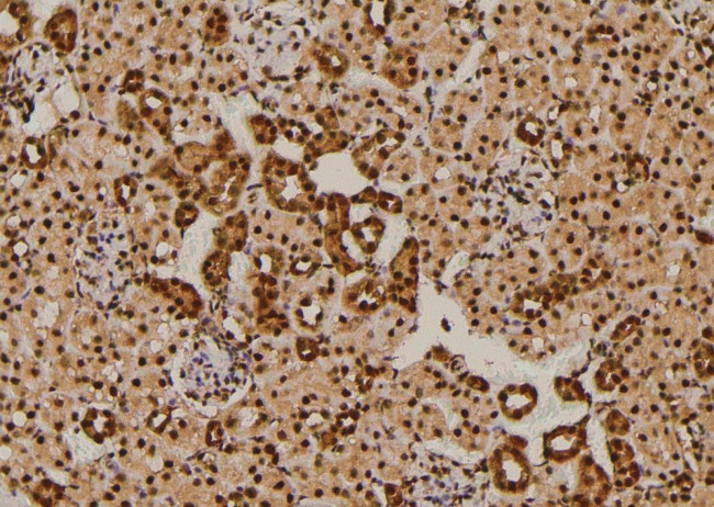 Phospho-NOTCH3 (Ser84) Antibody in Immunohistochemistry (Paraffin) (IHC (P))