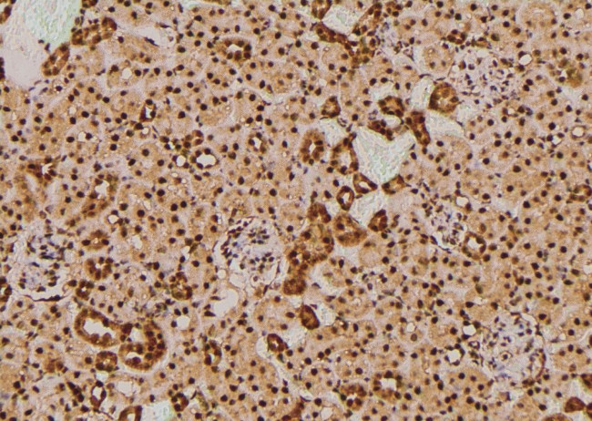 Phospho-NOTCH3 (Ser84) Antibody in Immunohistochemistry (Paraffin) (IHC (P))