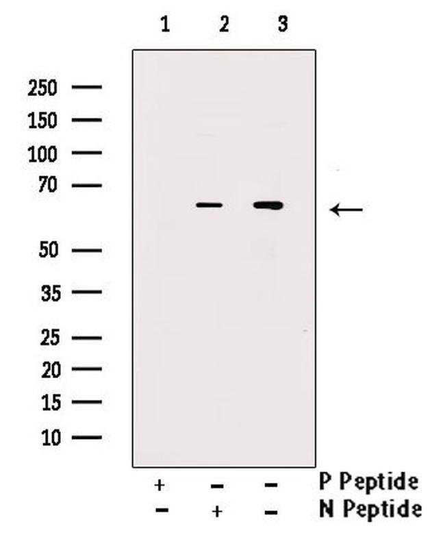 Phospho-SGLT1 (Ser335) Antibody in Western Blot (WB)