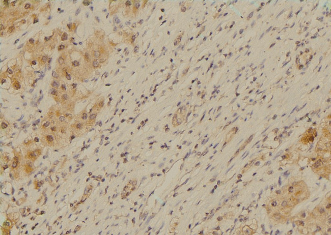 Phospho-SETD2 (Ser532) Antibody in Immunohistochemistry (Paraffin) (IHC (P))