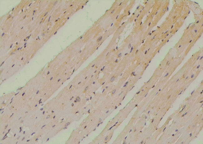 Phospho-SETD2 (Ser532) Antibody in Immunohistochemistry (Paraffin) (IHC (P))