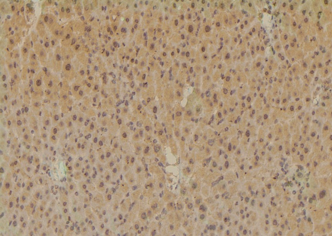 Phospho-SETD2 (Ser532) Antibody in Immunohistochemistry (Paraffin) (IHC (P))