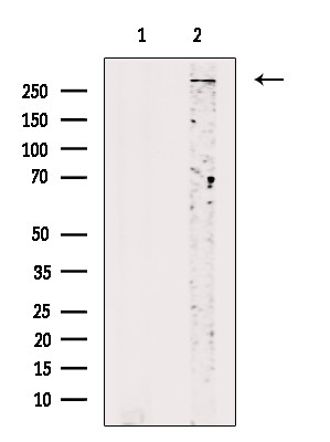 Phospho-SETD2 (Ser532) Antibody in Western Blot (WB)