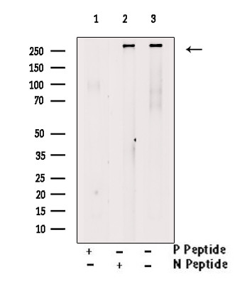 Phospho-SETD2 (Ser532) Antibody in Western Blot (WB)