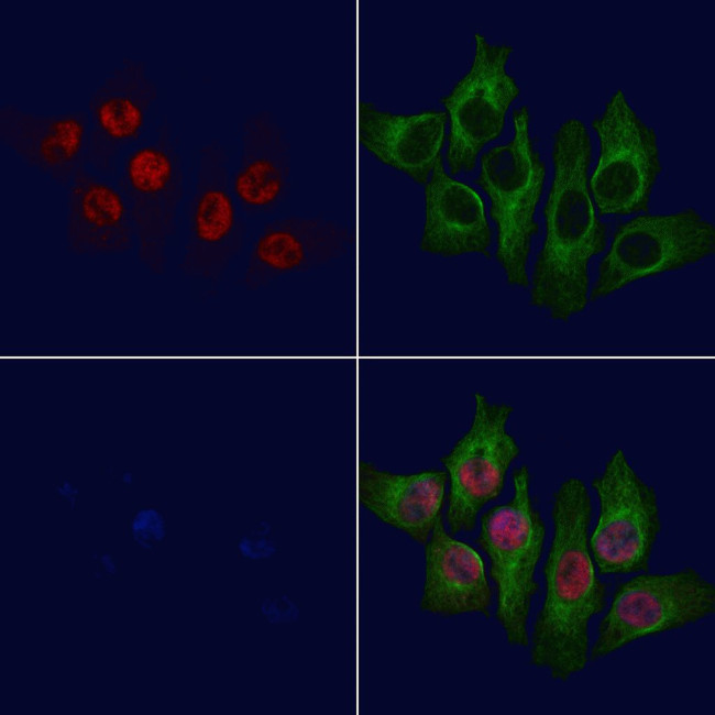 Phospho-SETD8 (Ser100) Antibody in Immunocytochemistry (ICC/IF)