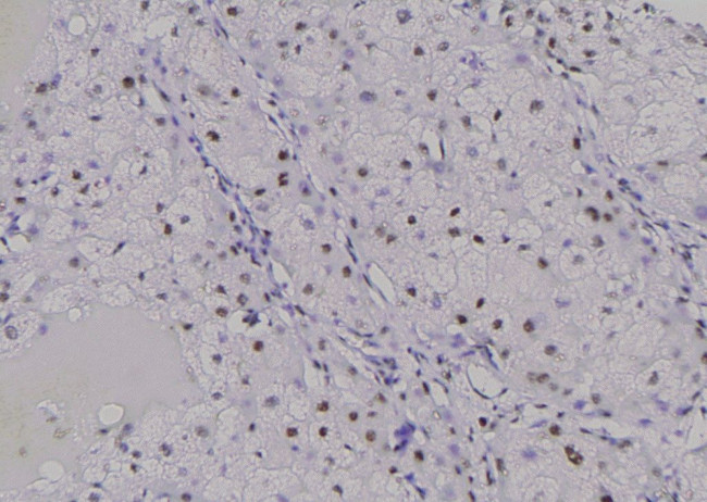 Phospho-SETD8 (Ser100) Antibody in Immunohistochemistry (Paraffin) (IHC (P))