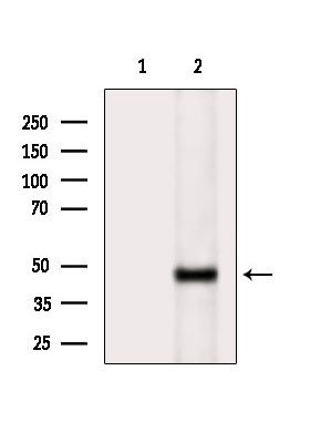 Phospho-HFE2 (Ser48) Antibody in Western Blot (WB)