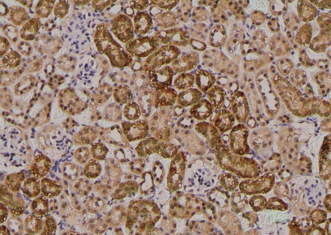 Phospho-HFE2 (Ser48) Antibody in Immunohistochemistry (Paraffin) (IHC (P))