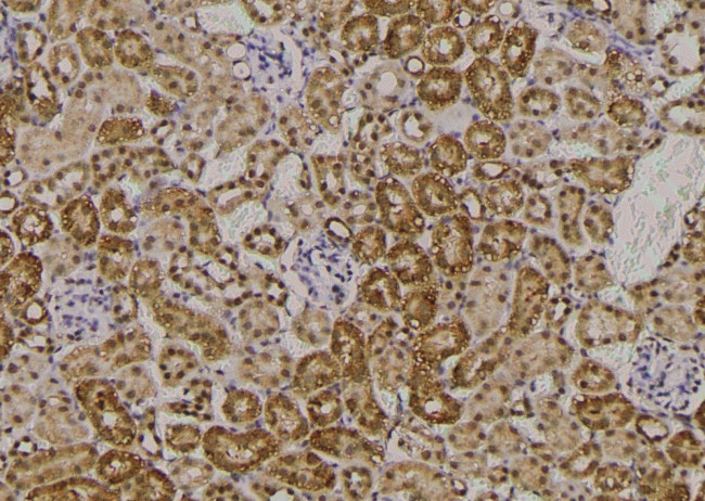 Phospho-HFE2 (Ser48) Antibody in Immunohistochemistry (Paraffin) (IHC (P))