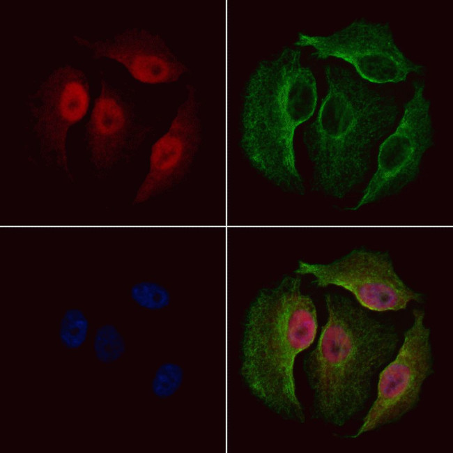 Phospho-NEK2 (Ser171) Antibody in Immunocytochemistry (ICC/IF)