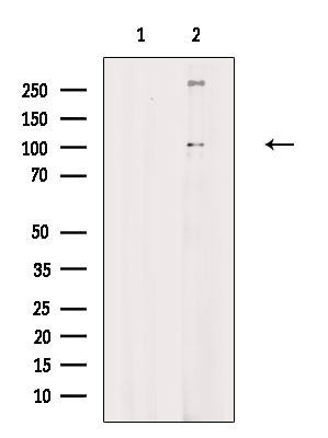 Phospho-ADAM9 (Thr761) Antibody in Western Blot (WB)