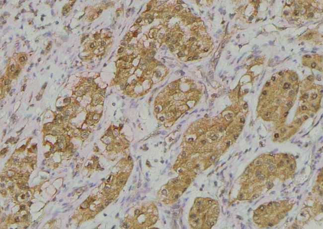 Phospho-ADAM9 (Thr761) Antibody in Immunohistochemistry (Paraffin) (IHC (P))