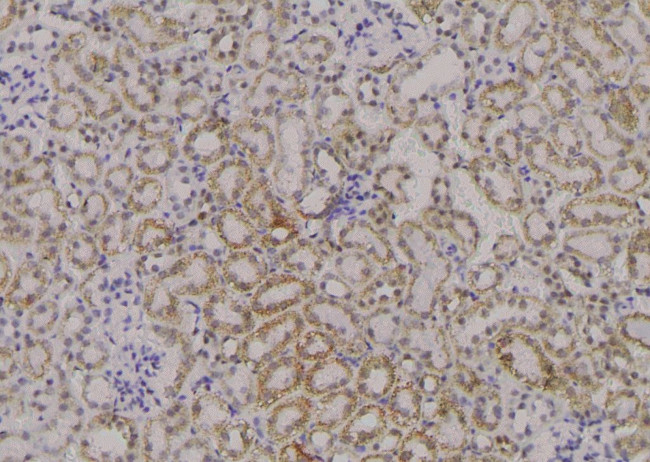 Phospho-ADAM9 (Thr761) Antibody in Immunohistochemistry (Paraffin) (IHC (P))