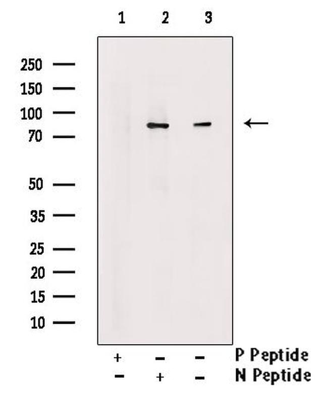 Phospho-PFKM (Ser74) Antibody in Western Blot (WB)