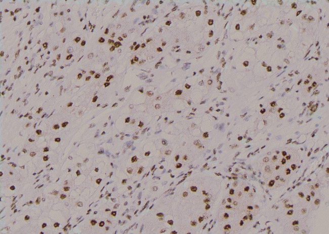 Phospho-FKBP4 (Tyr220) Antibody in Immunohistochemistry (Paraffin) (IHC (P))