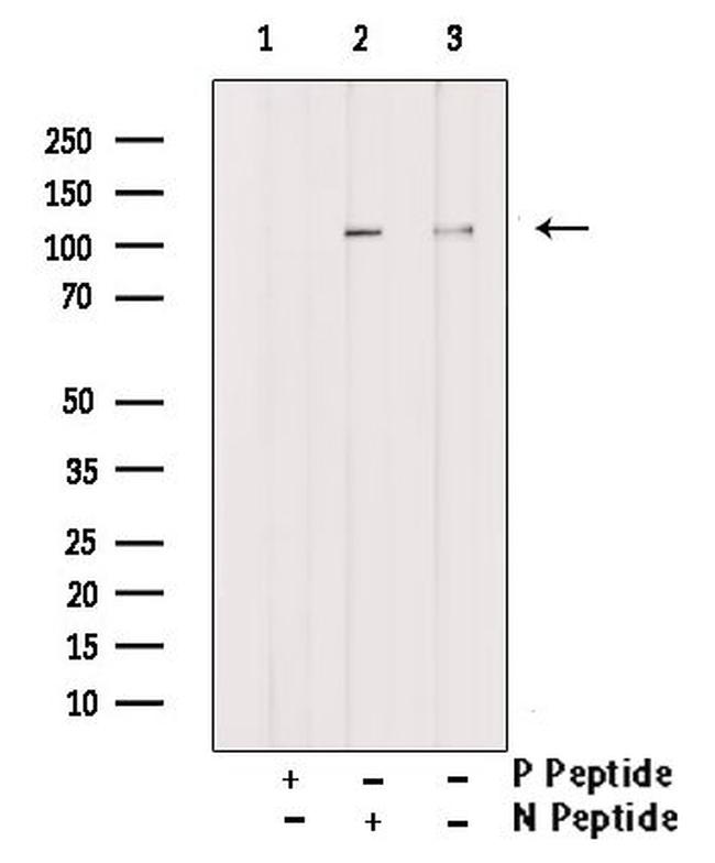 Phospho-GLI1 (Ser1071) Antibody in Western Blot (WB)