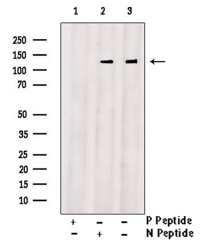 Phospho-GLI2 (Ser234) Antibody in Western Blot (WB)