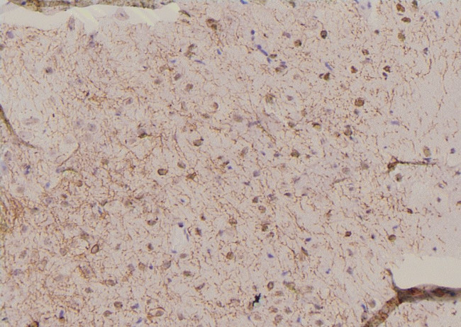 Phospho-TRIM32 (Ser339) Antibody in Immunohistochemistry (Paraffin) (IHC (P))