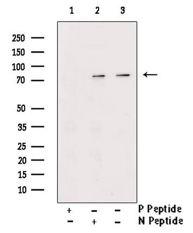 Phospho-TRIM32 (Ser339) Antibody in Western Blot (WB)