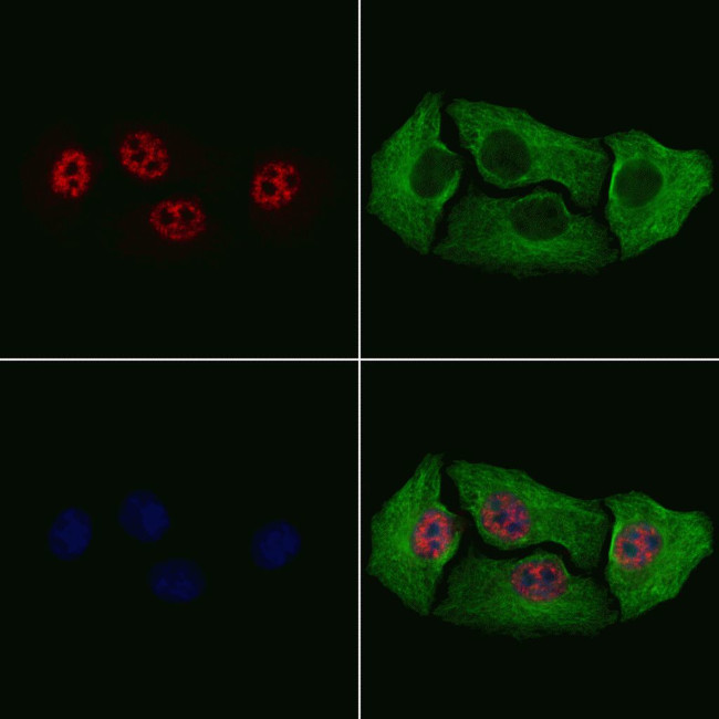 Phospho-HES1 (Ser37) Antibody in Immunocytochemistry (ICC/IF)