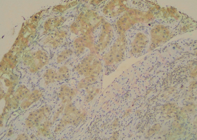 Phospho-PINK1 (Ser228) Antibody in Immunohistochemistry (Paraffin) (IHC (P))