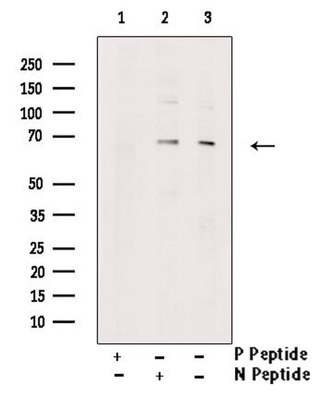 Phospho-PINK1 (Ser228) Antibody in Western Blot (WB)
