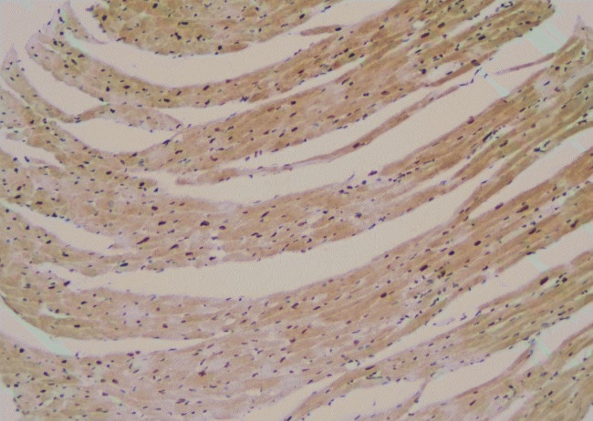 Phospho-PAX7 (Ser203) Antibody in Immunohistochemistry (Paraffin) (IHC (P))