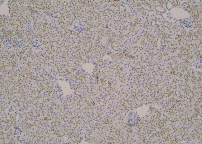 Phospho-LPIN1 (Thr14) Antibody in Immunohistochemistry (Paraffin) (IHC (P))