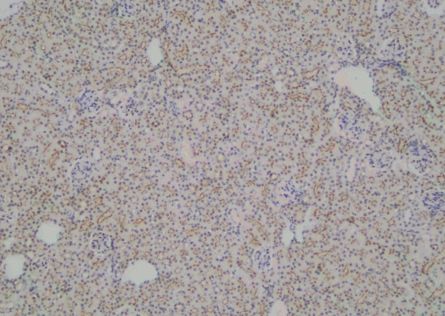 Phospho-LPIN1 (Thr14) Antibody in Immunohistochemistry (Paraffin) (IHC (P))