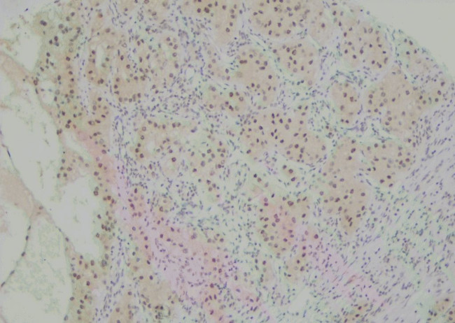 Phospho-Annexin A4 (Tyr255) Antibody in Immunohistochemistry (Paraffin) (IHC (P))