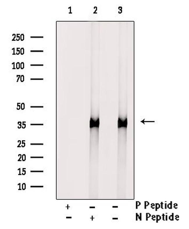 Phospho-Annexin A4 (Tyr255) Antibody in Western Blot (WB)