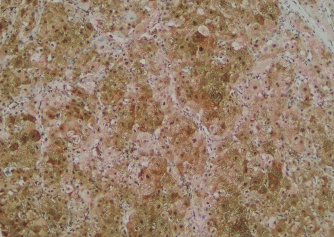 Phospho-RIP1 (Tyr384) Antibody in Immunohistochemistry (Paraffin) (IHC (P))