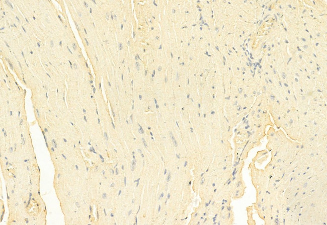 Phospho-RIP1 (Tyr384) Antibody in Immunohistochemistry (Paraffin) (IHC (P))