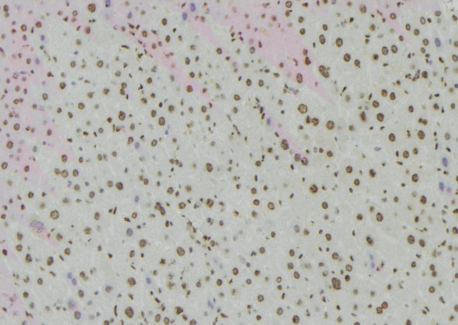 Phospho-BACH1 (Ser445) Antibody in Immunohistochemistry (Paraffin) (IHC (P))