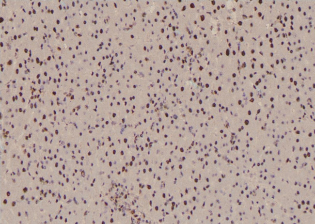 Phospho-BACH1 (Ser445) Antibody in Immunohistochemistry (Paraffin) (IHC (P))