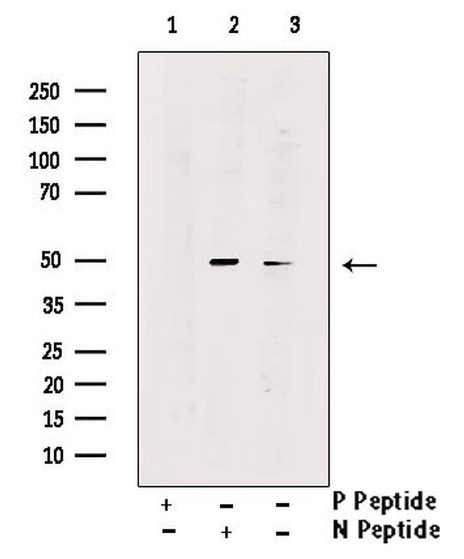 Phospho-SMYD2 (Ser283) Antibody in Western Blot (WB)