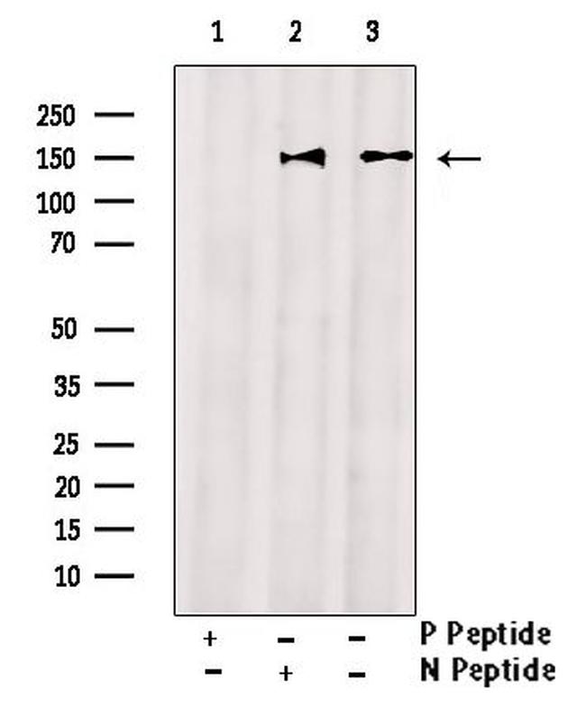 Phospho-ABCB11 (Ser690) Antibody in Western Blot (WB)