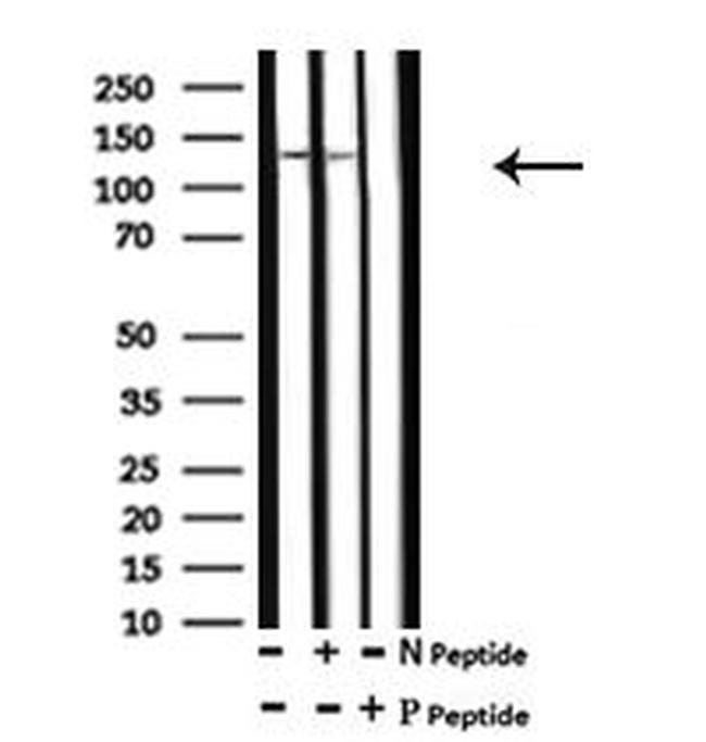 Phospho-ABCB11 (Ser690) Antibody in Western Blot (WB)