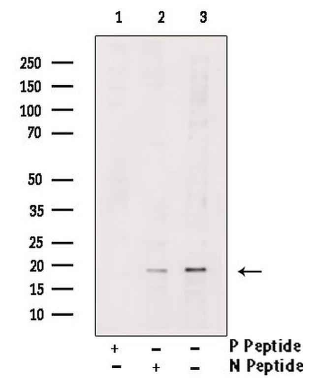 Phospho-PDCD5 (Ser119) Antibody in Western Blot (WB)
