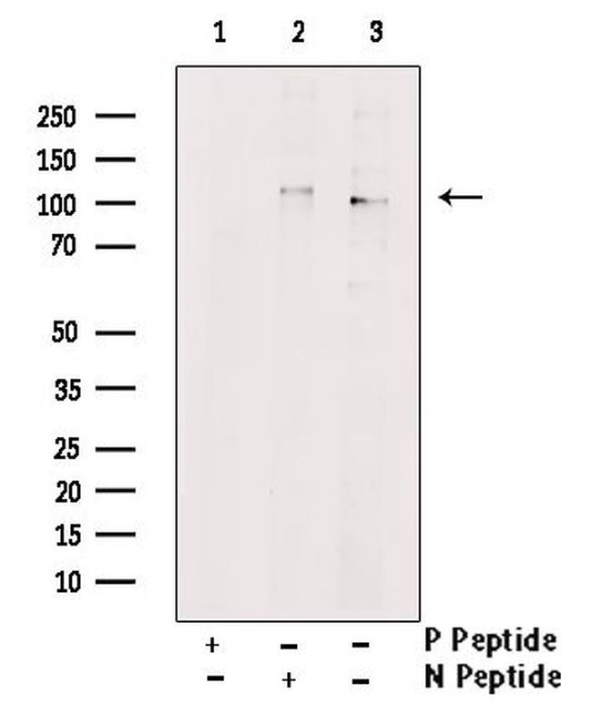 Phospho-MYPT1 (Tyr766) Antibody in Western Blot (WB)