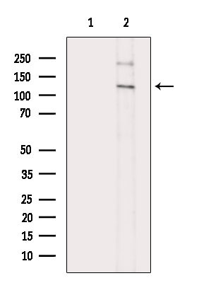 Phospho-MUSK (Tyr751) Antibody in Western Blot (WB)