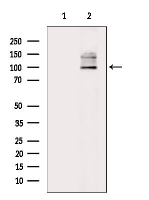 Phospho-MUSK (Tyr755) Antibody in Western Blot (WB)