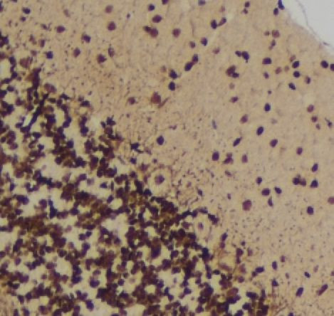 Phospho-MUSK (Tyr755) Antibody in Immunohistochemistry (Paraffin) (IHC (P))