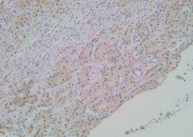 Phospho-SHIP2 (Tyr886) Antibody in Immunohistochemistry (Paraffin) (IHC (P))