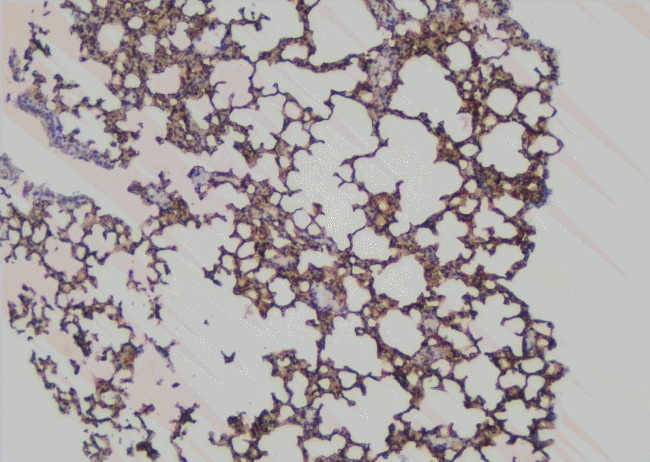 Phospho-SHIP2 (Tyr886) Antibody in Immunohistochemistry (Paraffin) (IHC (P))