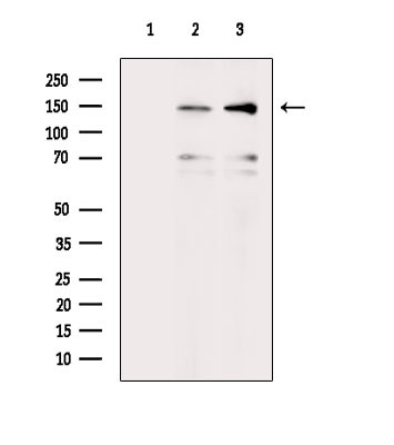 Phospho-SHIP2 (Tyr886) Antibody in Western Blot (WB)