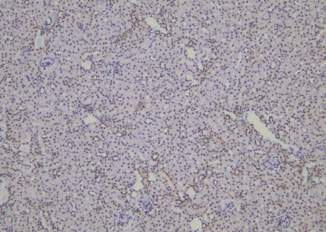 Phospho-SHIP2 (Tyr671) Antibody in Immunohistochemistry (Paraffin) (IHC (P))