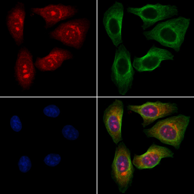 Phospho-TAK1 (Ser389) Antibody in Immunocytochemistry (ICC/IF)