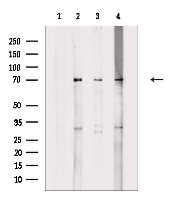 Phospho-TAK1 (Ser389) Antibody in Western Blot (WB)