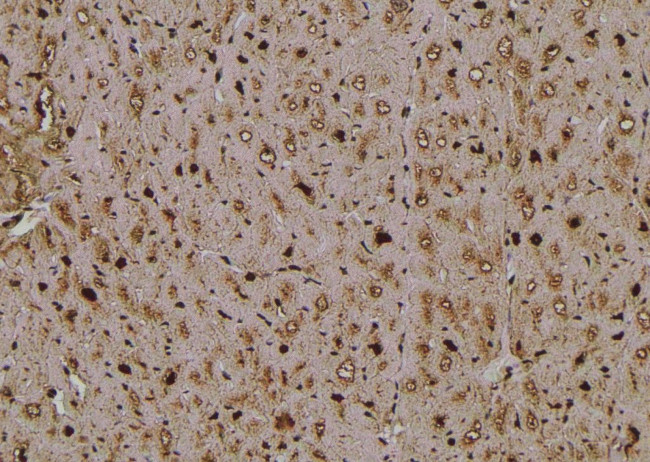 Phospho-TAK1 (Ser192) Antibody in Immunohistochemistry (Paraffin) (IHC (P))